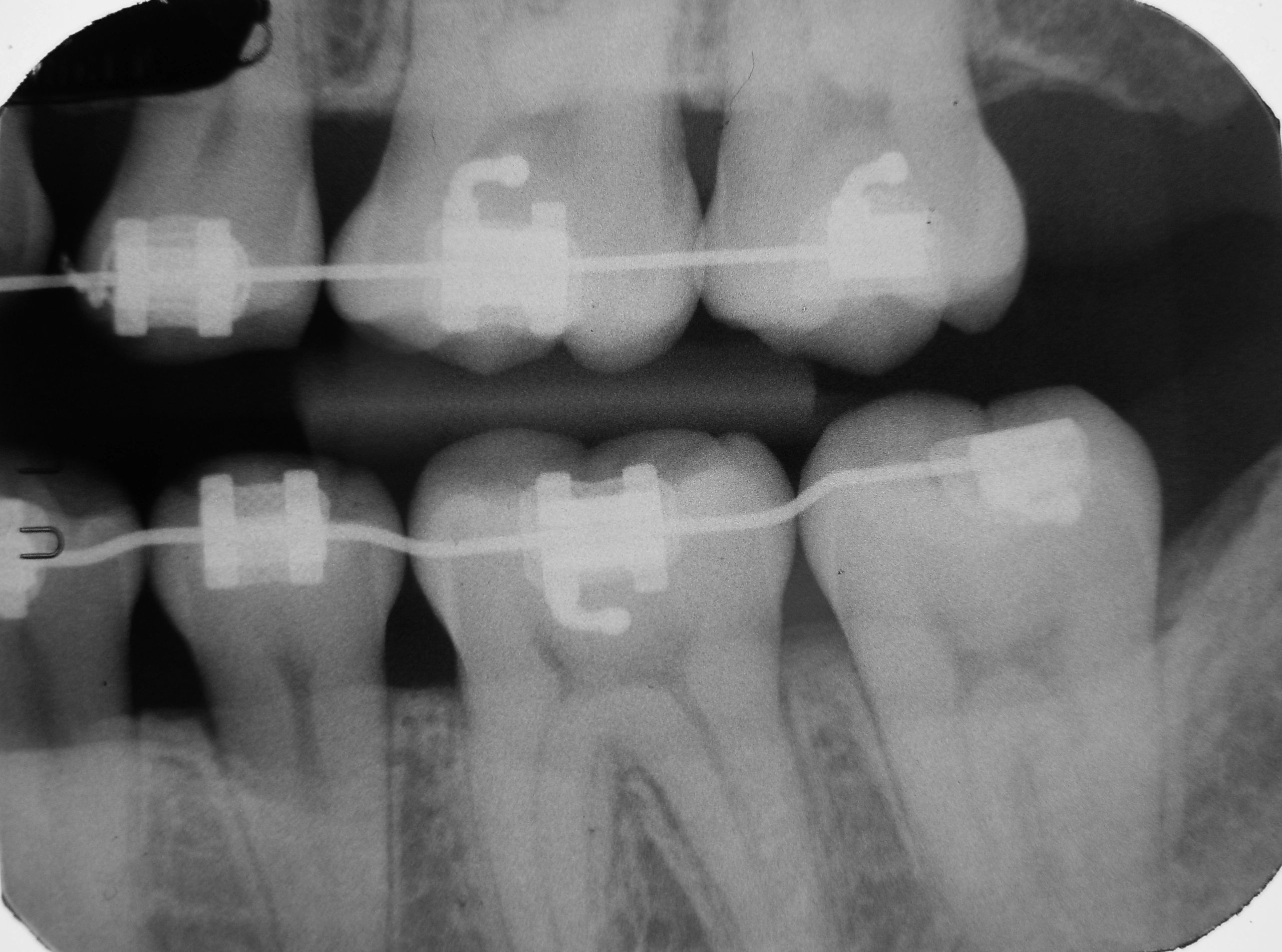 RadiografÃa extraoral dental