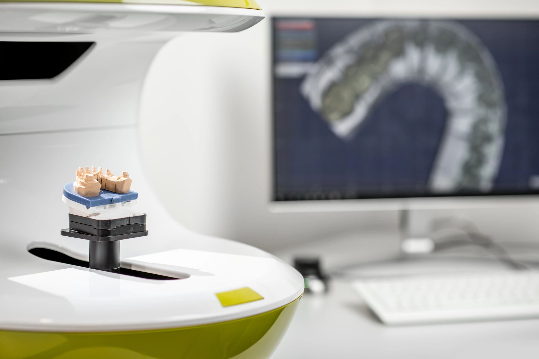 Tomografía dental y escaneo 3D