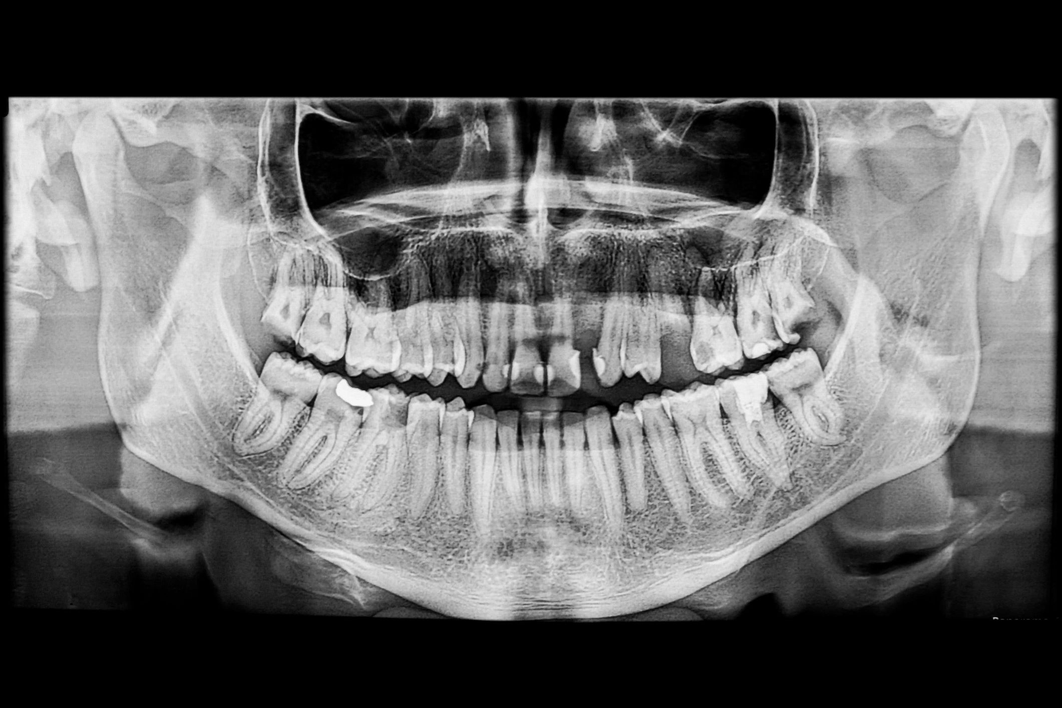 Radiografía panorámica dental